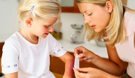 Image Рани, опіки, виразки