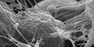 Порушення біоплівки: поєднання фагів з іншими агентами