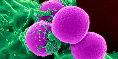 ВООЗ повідомляє про зростання стійкості до антимікробних препаратів у всьому світі