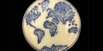 Вчені відстежили поширення стійкості до антибіотика «останнього резерву».