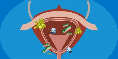 Розпочато клінічні випробування фагової терапії інфекцій сечовивідних шляхів