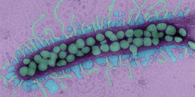 Клінічні випробування фаготерапії в США