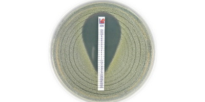 Антибіотикорезистентність в Україні за результатами дослідження AURA (Частина 1)