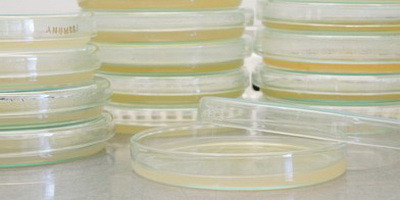 На крок ближче до фагової терапії інфекцій, стійких до антибіотиків